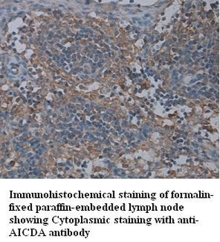 AICDA Rabbit Polyclonal Antibody