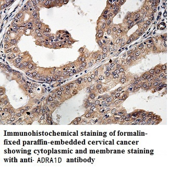 ADRA1D Rabbit Polyclonal Antibody