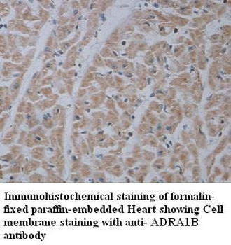 ADRA1B Rabbit Polyclonal Antibody