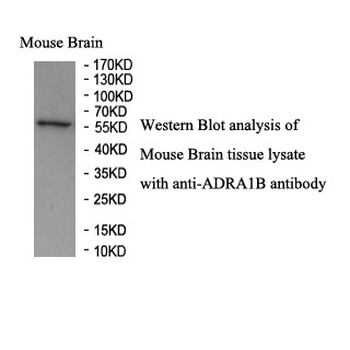 ADRA1B Rabbit Polyclonal Antibody