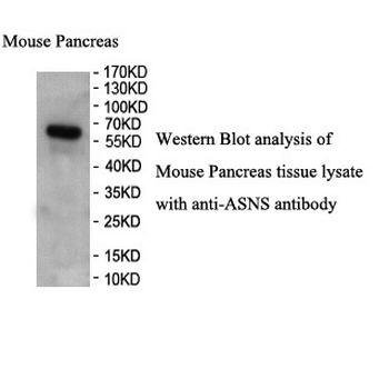 ASNS Rabbit Polyclonal Antibody