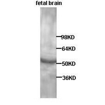 RAR alpha Rabbit Polyclonal Antibody