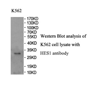 HES-1 Rabbit Polyclonal Antibody