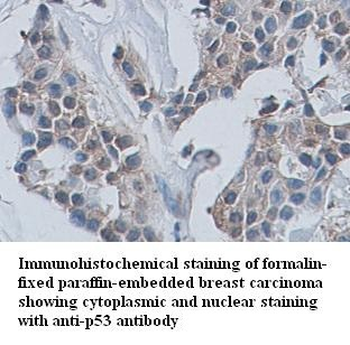 TP53 Rabbit Polyclonal Antibody