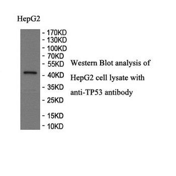 TP53 Rabbit Polyclonal Antibody