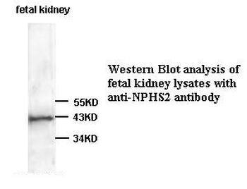 NPHS2 Rabbit Polyclonal Antibody