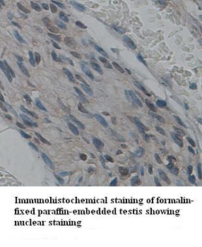 TdT Rabbit Polyclonal Antibody