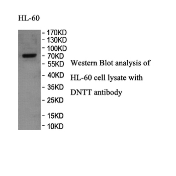 TdT Rabbit Polyclonal Antibody