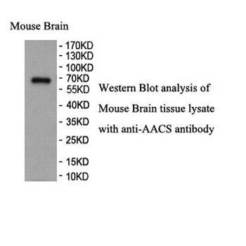 AACS Rabbit Polyclonal Antibody