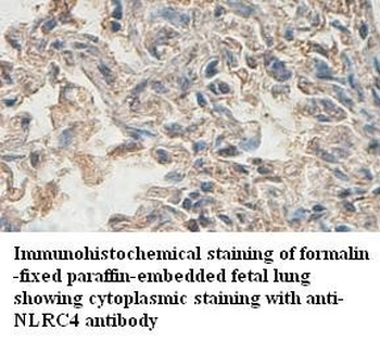 NLRC4 Rabbit Polyclonal Antibody