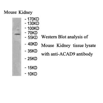 ACAD9 Rabbit Polyclonal Antibody
