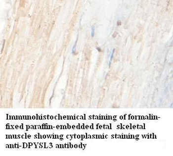 DPYSL3 Rabbit Polyclonal Antibody