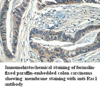 Rac1 Rabbit Polyclonal Antibody