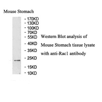 Rac1 Rabbit Polyclonal Antibody