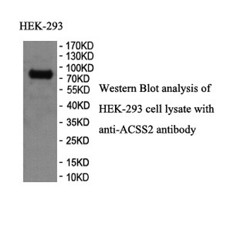 ACSS2 Rabbit Polyclonal Antibody