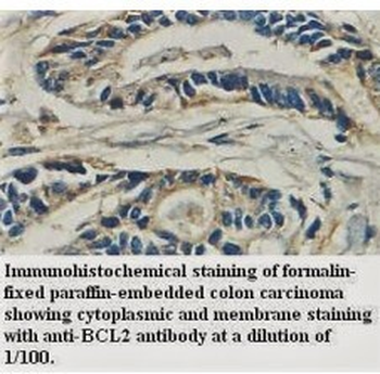 BCL2 Rabbit Polyclonal Antibody