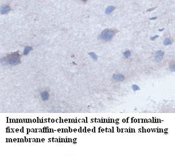 ACCN2 Rabbit Polyclonal Antibody