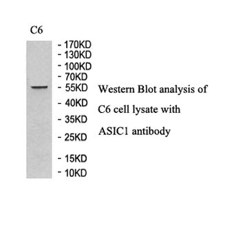 ACCN2 Rabbit Polyclonal Antibody