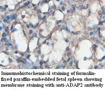 ADAP2 Rabbit Polyclonal Antibody