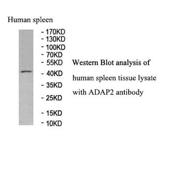 ADAP2 Rabbit Polyclonal Antibody