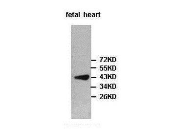 PIP5K2-beta Rabbit Polyclonal Antibody