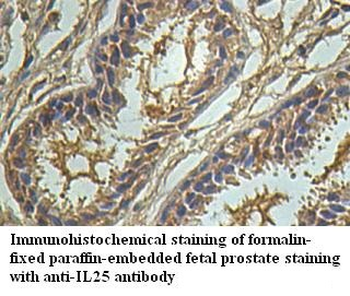 IL25 Rabbit Polyclonal Antibody