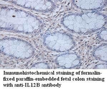 IL12B Rabbit Polyclonal Antibody