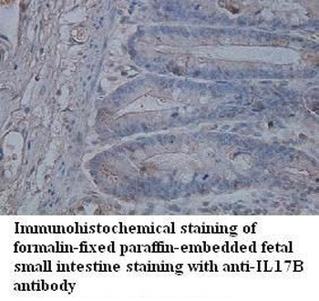 IL17B Rabbit Polyclonal Antibody