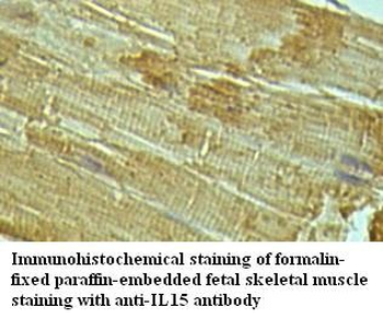 IL15 Rabbit Polyclonal Antibody