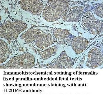 IL20RB Rabbit Polyclonal Antibody