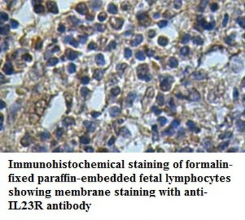 IL23R Rabbit Polyclonal Antibody
