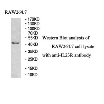 IL23R Rabbit Polyclonal Antibody