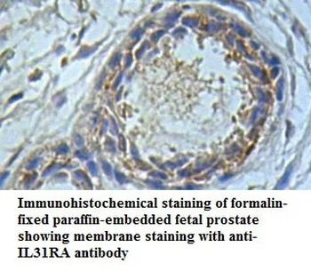 IL31RA Rabbit Polyclonal Antibody