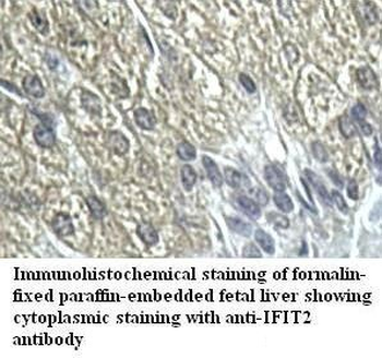 IFIT2 Rabbit Polyclonal Antibody