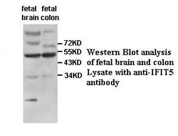 IFIT5 Rabbit Polyclonal Antibody