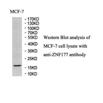 ZNF177 Rabbit Polyclonal Antibody