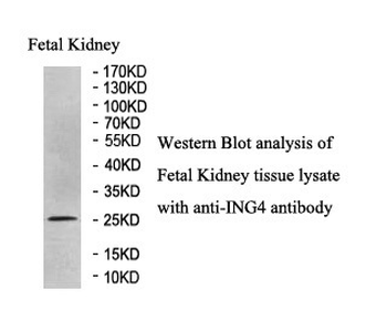 ING4 Rabbit Polyclonal Antibody