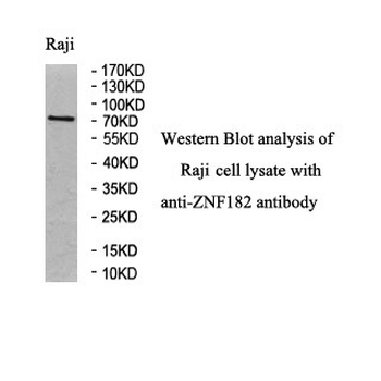 ZNF182 Rabbit Polyclonal Antibody