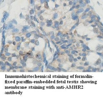 AMHR2 Rabbit Polyclonal Antibody