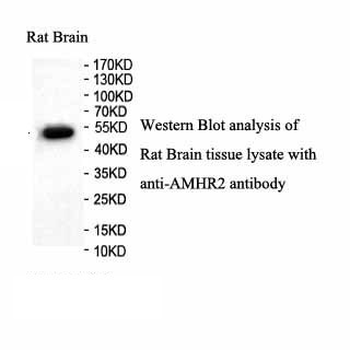 AMHR2 Rabbit Polyclonal Antibody