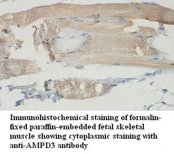 AMPD3 Rabbit Polyclonal Antibody