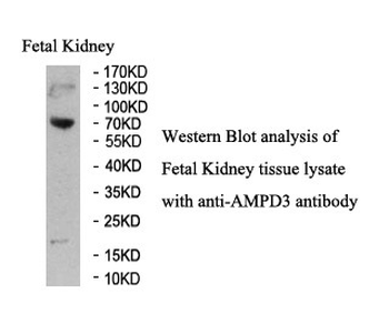 AMPD3 Rabbit Polyclonal Antibody
