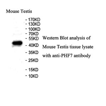 PHF7 Rabbit Polyclonal Antibody
