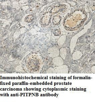 PITPNB Rabbit Polyclonal Antibody