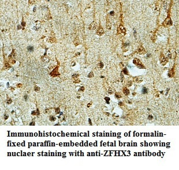 ZFHX3 Rabbit Polyclonal Antibody