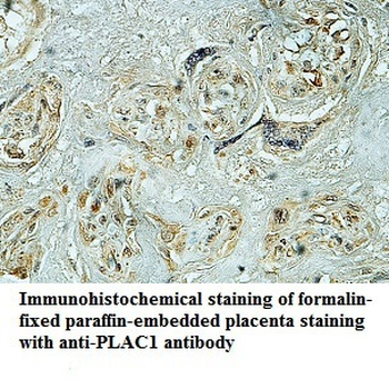 PLAC1 Rabbit Polyclonal Antibody