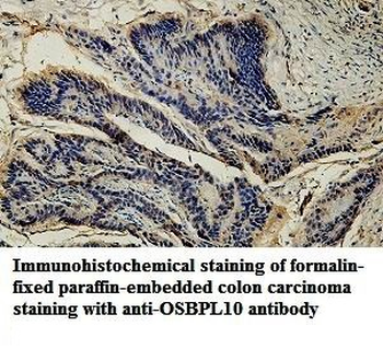 OSBPL10 Rabbit Polyclonal Antibody