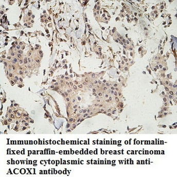 ACOX1 Rabbit Polyclonal Antibody