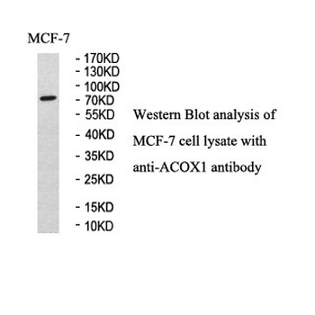 ACOX1 Rabbit Polyclonal Antibody