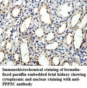 PPP5C Rabbit Polyclonal Antibody